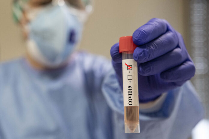 EMERGENZA CORONAVIRUS, PROVETTA LABORATORIO fondazione-gimbe-covid-allarme-contagi