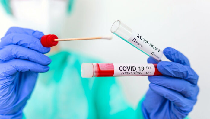TAMPONE-CORONAVIRUS-COVID-19 - SITO