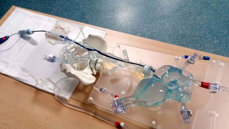 Frosinone- 40enne salvato da un infarto grazie ad una tecnologia innovativa