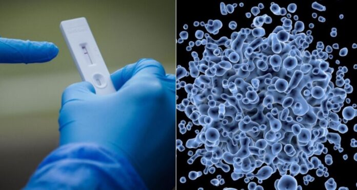 influenza australiana virus vaccini influenza australiana virus vaccini
